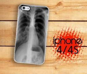 Iphone 4/4S Hard Case Chest XRay